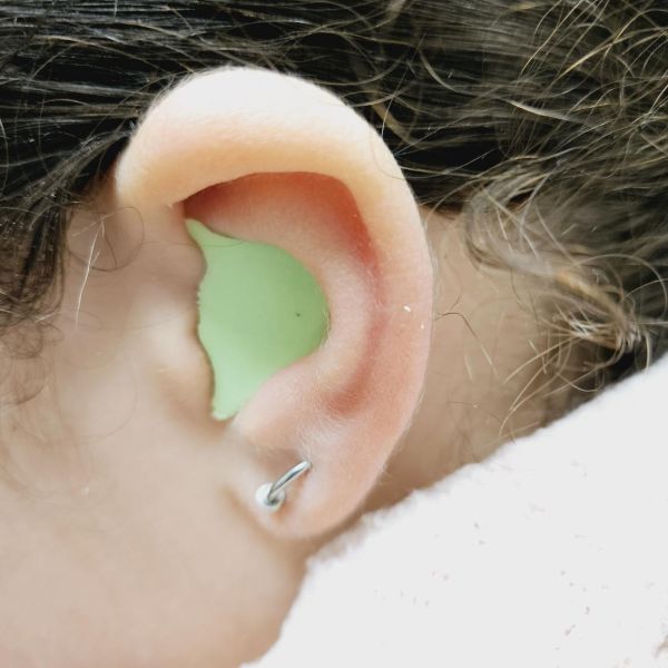 Bouchon d'oreille sur mesure enfant – protection contre l'eau et les otites Bouchon anti-eau sur mesure pour enfant porteur de drains transtympaniques à Valenciennes